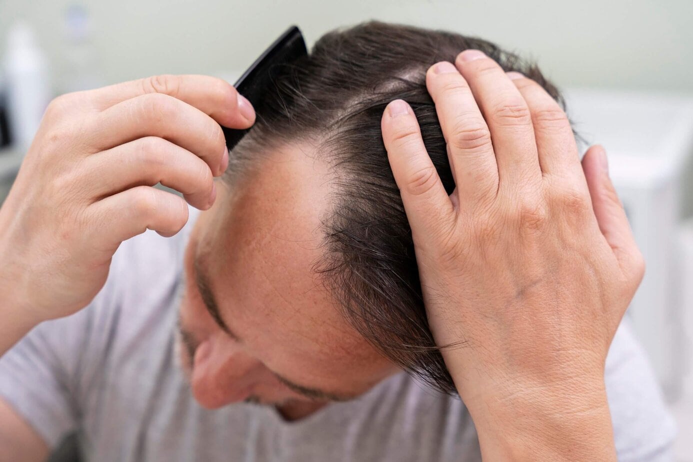 signs-of-hair-loss
